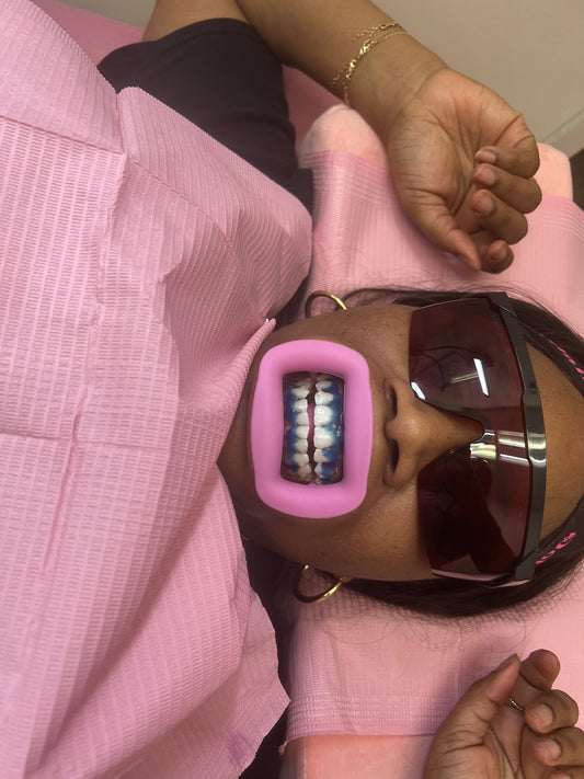 Toronto Teeth Whitening  Masterclass